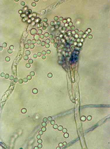 Penicillium chrysogenum – a source of penicillin